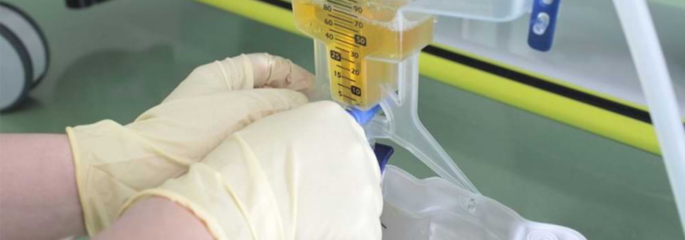 Zamena i plasiranje urinarnih katetera